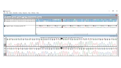 DS3000 Compact CE Sequencerにおける微生物同定の実例