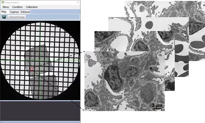 Specimen: Mouse kidney; Instrument: HT7800; Accelerating voltage: 80 kV; Direct magnification: ×2,000