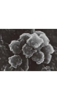 艾滋病病毒立体图像观察(1985年)引发全球关注 （图片来源：已故田中敬一&middot;鸟取大学名誉教授）