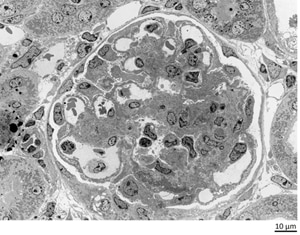 使用TEM观察大鼠肾脏实例