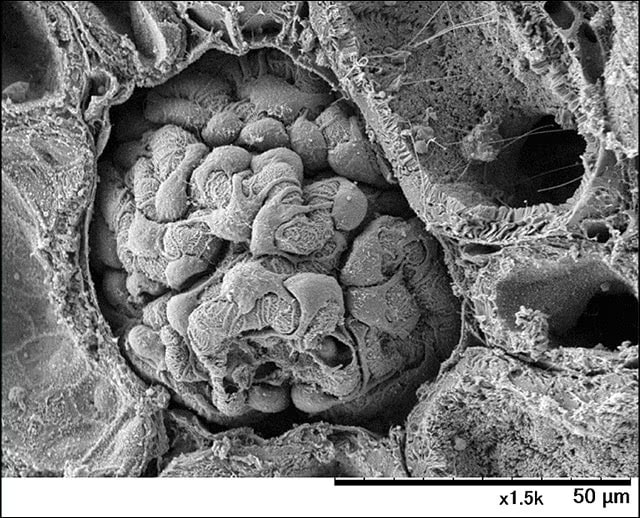 Image of Kidney glomerulus