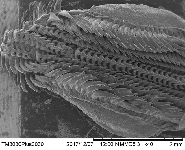 Electron microscope photograph of a squid radula
