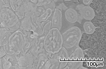 Electron microscope image