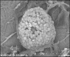 Image of Mast cell