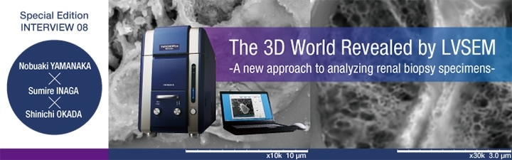 The 3D World Revealed by LVSEM