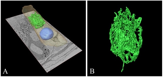 3D reconstructed images of the Golgi apparatus in an epithelial principal cell in a rat epididymis.
