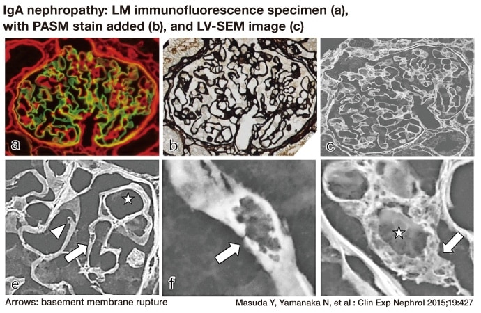 Fig. 7　Correspondence between LV-SEM images and LM immunofluorescence findings