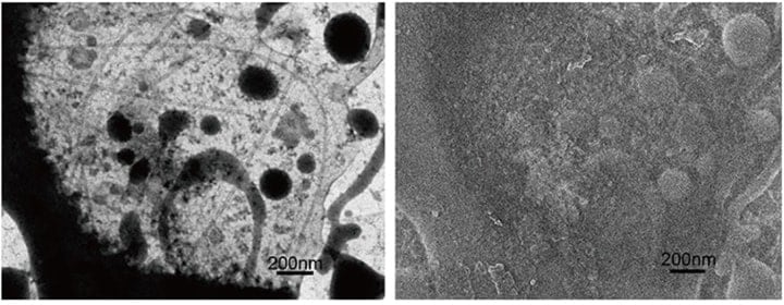 Fig. 6　Simultaneously recorded cryo-STEM (left) and cryo-SEM (right) images (for an unfixed sample). Initially, the sample is fully embedded in ice and the SEM image is flat owing to the ice coating. As the electron-beam irradiation induces a temperature increase, a portion of the ice sublimates, yielding the structure seen in the figure at right.