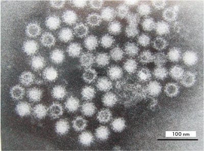 Fig. 1  Transmission electron microscope photograph of human norovirus particles Uranyl acetate staining  Bar: 100 nm