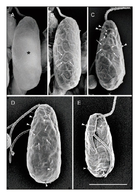 Fig. 3 SEM images of the glaucophyte <i>Cyanophora paradoxa</i>. Comparison of SEM techniques. Bar = 5 μm.