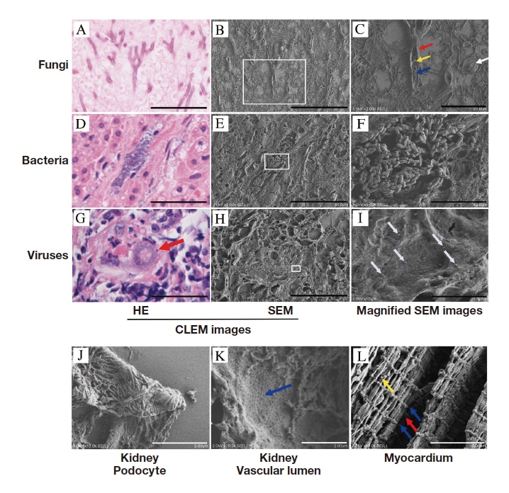 Fig. 2 CLEM high-resolution SEM micrographs of FFPE sections (secondary electron mode)