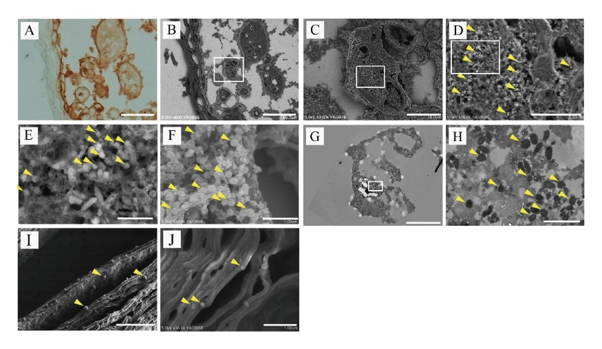 Fig. 3 CLEM micrographs of immunostained varicella zoster virus (VZV) samples