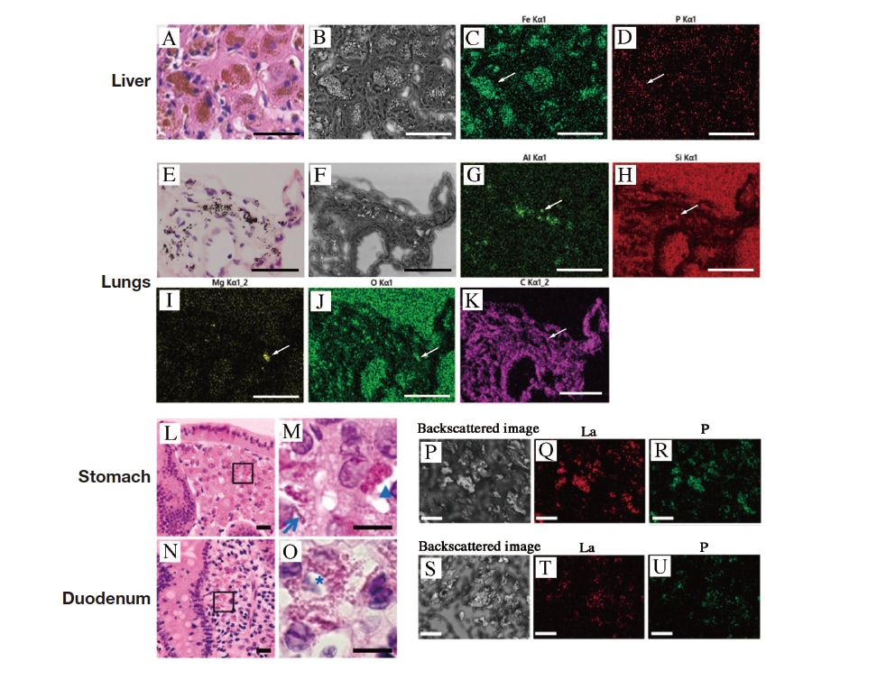 Fig. 4 Elemental analysis of FFPE slices