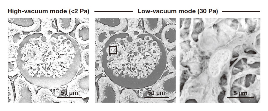Fig. 2 Micrographs illustrating the difference between high- and low-vacuum modes. Rat renal corpuscle. High-vacuum mode(<2 Pa) (left). High electrostatic charge prevents analysis. Low-vacuum mode(30 Pa) (center and right). With the electrostatic charge greatly reduced, the area within the square in the center micrograph can be analyzed at high magnification(right).