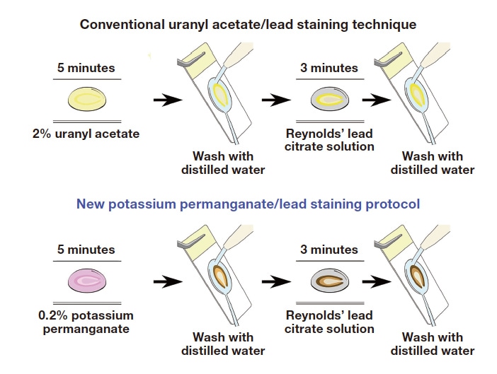 Fig. 3 Conventional uranyl acetate/lead staining technique(top) and new potassium permanganate/lead staining protocol(bottom)