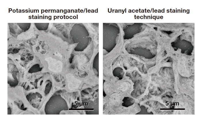 Fig. 4 Rat renal glomerulus. This side-by-side comparison shows tissue stained with the new potassium permanganate/lead staining protocol(left) and conventional uranyl acetate/lead staining technique(right). This comparison highlights the attractiveness of the ability to convert samples prepared for light microscopy into samples for electron microscopy and the power of lowvacuum scanning electron microscopy. Fixing fluid: 2 % paraformaldehyde + 2.5 % glutaraldehyde. Section thickness: 5 μm.