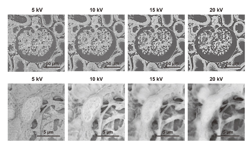 Fig. 5 Micrographs obtained at different accelerating voltages. Note how a low accelerating voltage reduces the contrast but makes the cell surface architecture clear, while a high accelerating voltage increases the contrast but obscures the architecture. We recommend using a voltage of 15 to 20 kV for low-magnification(<500×) microscopy and 5 to 10 kV for high-magnification(≥500×) microscopy.