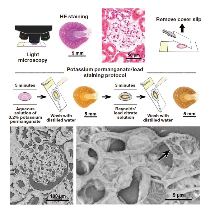 Fig. 8 Micrographs of rat renal corpuscle imaged with CLEM. The sample was first stained with hematoxylin and eosin and observed using light microscopy. The cover slip was then removed, and the sample was stained with potassium permanganate/lead and observed using low-vacuum scanning electron microscopy. The area observed with light microscopy is seen in elaborate detail. The protrusions of the podocytes seen with light microscopy(arrow) are imaged at a resolution not possible with light microscopy, revealing the fine-grained structure.