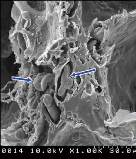 Figure 1: SEM image of bread (Hitachi S4000) after fixation with glutaraldehyde and osmium tetroxide, drying, and ion-coating with Au. (Arrows indicate starch grains in flour gelatinized by heating)