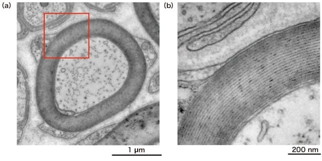 Fig. 3 Example of a high-contrast observation of an unstained fragment of a living organism Instrument: HT7800 Sample: Rat sciatic nerve Accelerating voltage: 80 kV Magnification: (a) ×12,000, (b) ×40,000