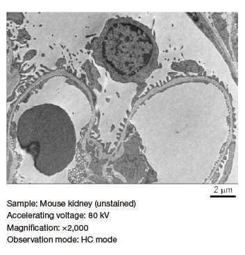 Fig. 5 High-contrast image observation of unstained mouse kidney sample
