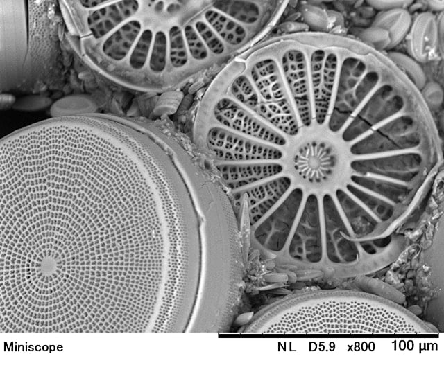 児童が観察した珪藻の電子顕微鏡写真