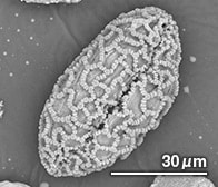 ユリの花粉（顕微鏡写真）
