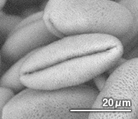 グロリオサの花粉（顕微鏡写真）