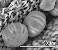 ラベンダーの花粉（顕微鏡写真）