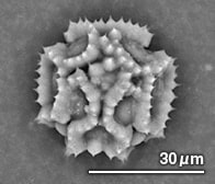 タンポポの花粉（顕微鏡写真）