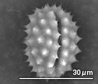 ハルジオンの花粉（顕微鏡写真）