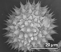 ヒャクニチソウの花粉（顕微鏡写真）