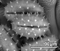 フキノトウの花粉（顕微鏡写真）