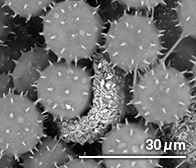 フヨウの花粉（顕微鏡写真）