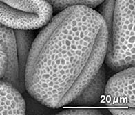 ムラサキカタバミの花粉（顕微鏡写真）