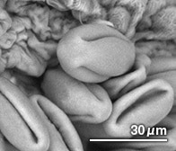 ウメの花粉（顕微鏡写真）