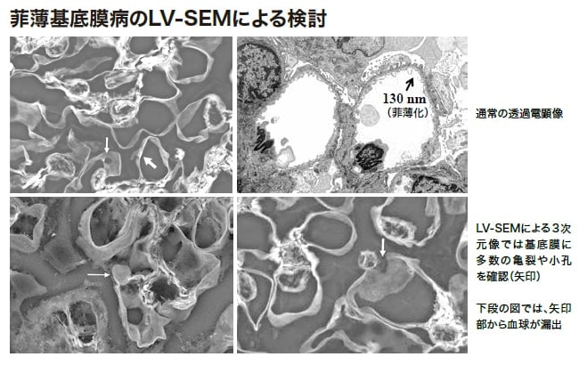 菲薄基底膜病の糸球体LV-SEM画像