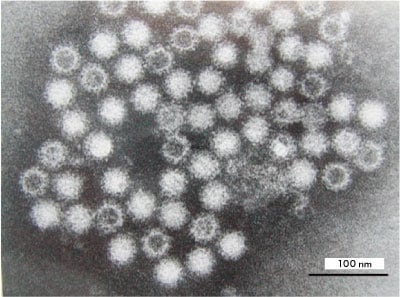 図1　ヒトノロウイルス粒子の透過型電子顕微鏡（TEM）写真　醋酸ウラン染色　 Bar: 100 nm