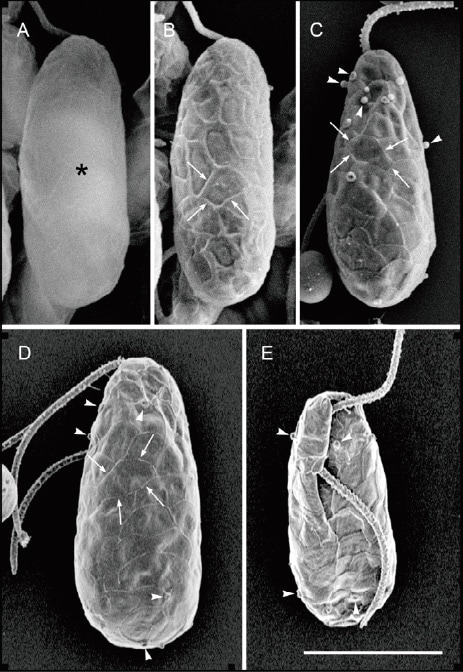 図3　灰色植物キアノポラ・パラドクサ（Cyanophora paradoxa）を用いた走査電子顕微鏡（SEM）法の比較。Bar = 5 µm。（A）四酸化オスミウム単固定、汎用SEM像、加速電圧15 kV。（B）四酸化オスミウム単固定、汎用SEM像、加速電圧5 kV。低加速電圧で表面構造が現れた。（C）四酸化オスミウム・グルタールアルデヒド二重固定、汎用SEM像、加速電圧5 kV。　固定法をよりマイルドなものとすることでアーティファクトの少ない構造が観察できた。（D、E）四酸化オスミウム・グルタールアルデヒド二重固定、電界放出形（FE-）SEM像、加速電圧1 kV。低加速電圧FE-SEM法によって、嶺で囲まれた模様が鮮明に観察できた。文献10）より転用した。日本メンデル協会の転載許可による。