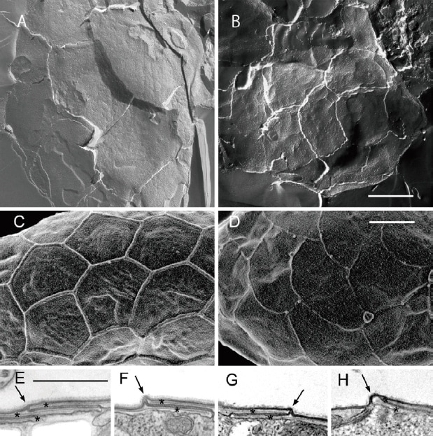 図5　フリーズフラクチャ透過電子顕微鏡（TEM）（A、B）、電界放出形走査電子顕微鏡写真（C、D）と超薄切片TEM（E-H）。細胞表面全体を覆う模様は嶺により縁どられるが、嶺はプレート小胞の境界における反り上がりによって形成され、模様は内部のプレートの形態を反映していた。Bar = 1 µm。（A、C、E、F）新種キアノポラ・スダーエ（Cyanophora sudae）。（B、D、G、H）キアノポラ・ビローバ（C. biloba）。文献3）より引用・改変した。John Wiley and Sonsの転載許可による（License Number: 3790920895102）。