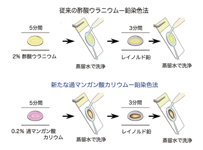 図3 従来の酢酸ウラニウムー鉛染色法（上段）と新たに開発した過マンガン酸カリウムー鉛染色法（下段）。