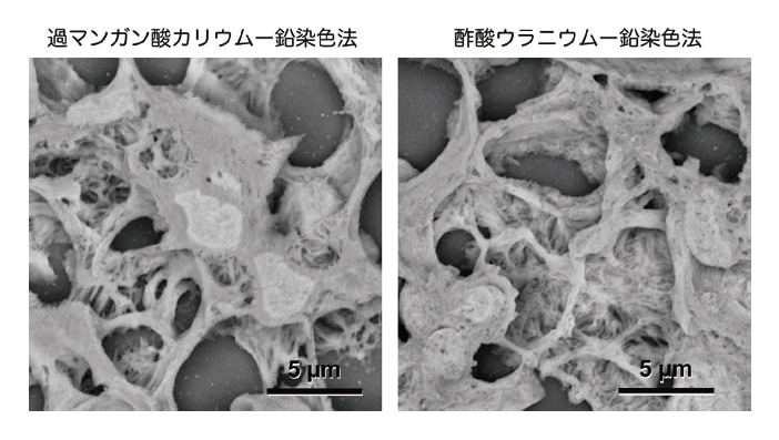 図4 ラット腎糸球体。新たな過マンガン酸カリウムー鉛染色法（左）と従来の酢酸ウラニウムー鉛染色法（右）の比較画像。光顕用に作製された試料を電顕試料に進化させる過マンガン酸カリウムー鉛染色法の魅力と低真空走査型電子顕微鏡の威力に注目。固定液＝2％パラフォルムアルデヒド＋2.5％グルタルアルデヒド混合液。切片厚＝5 μm。
