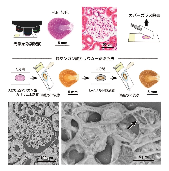 図8 光顕ー電顕相関観察法（CLEM）によるラット腎小体の観察例。常法のヘマトキシリン・エオジン染色で光顕観察後、カバーガラスを除去して過マンガン酸カリウムー鉛染色を施し、低真空走査型電子顕微鏡で観察。光顕で撮影した同じ部位を高精細に観察することが可能で、光顕レベルでは確認できない微細構造が可視化され、足細胞の突起（矢印）を判別することができる。