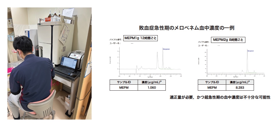 図2 LM1010による血中濃度測定の例