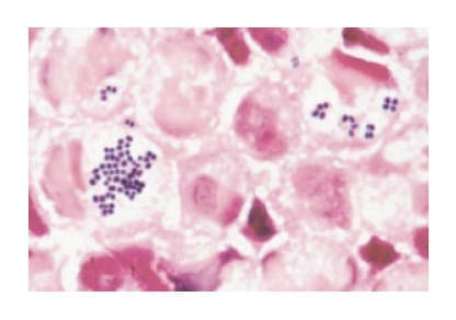 図3 グラム染色によりグラム陽性球菌を検出 永田邦昭. 感染症診断に役立つグラム染色. 15頁, 2006年から引用