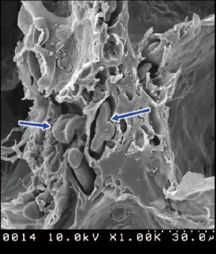 図１：食パンをグルタルアルデヒド・オスミウム酸固定後、乾燥し、Auでイオンコーティング後、走査電子顕微鏡（日立S-4000）で観察（矢印：加熱により糊化変形した小麦粉のデンプン粒）　