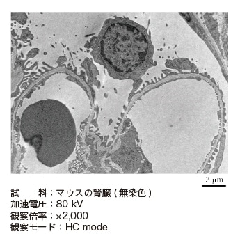 図5　マウスの腎臓の無染色切片の高コントラスト観察例