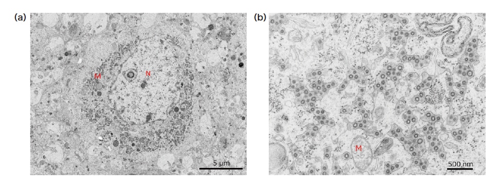 図4 ブタコロナウイルスに感染したラット大脳皮質樹脂包埋超薄切片のTEM像