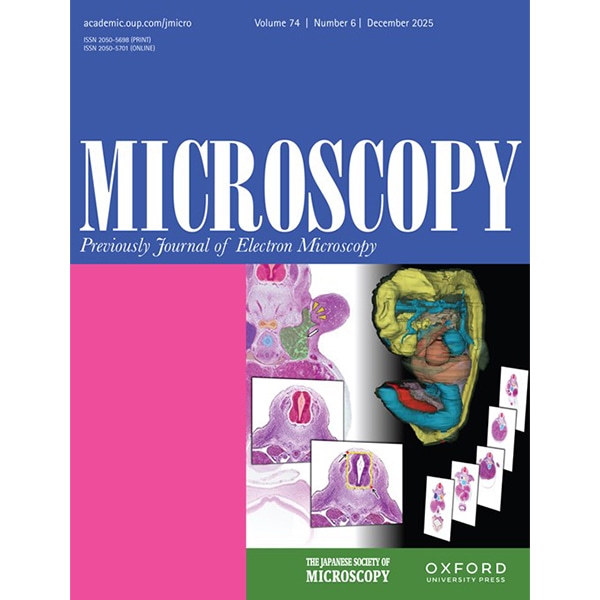 Ultra-low-voltage observation of battery materials by scanning electron microscopy